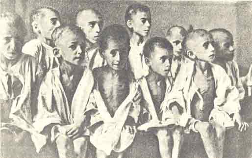 Emaciated Greek Children During The Occupation (1941-1942)